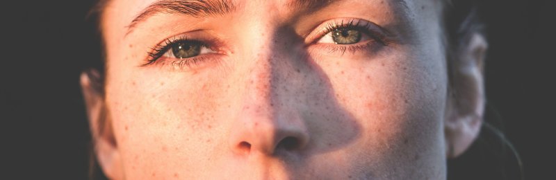 皮肤痘痘 Skin acne