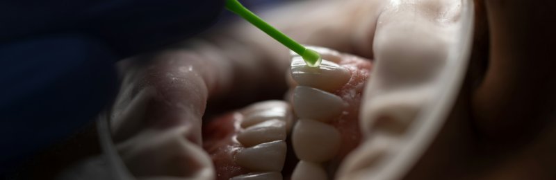 洗牙 Toothwashing